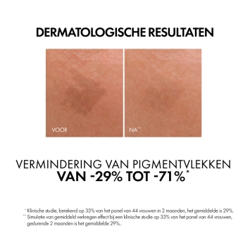 Vichy Liftactiv B3 Anti-Pigmentvlekken Serum 30ml